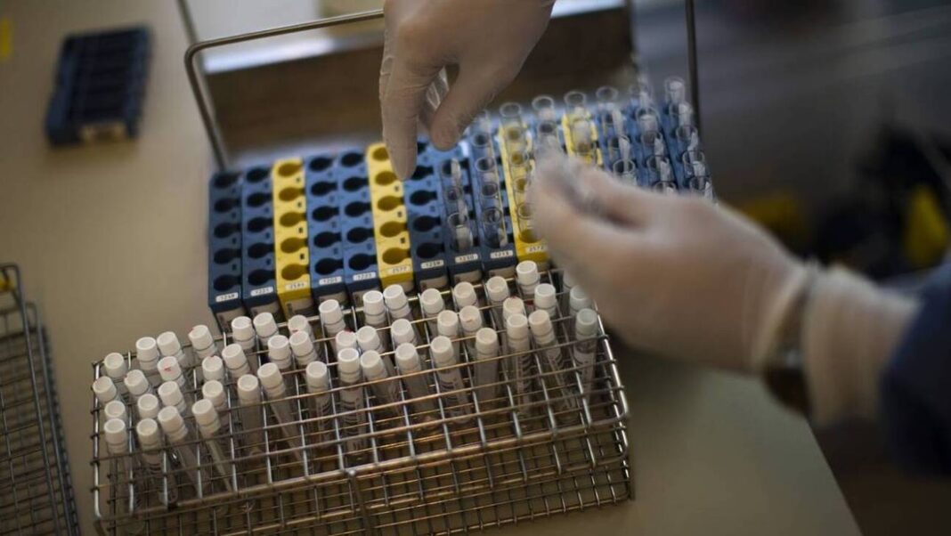 Μαζικοί προληπτικοί έλεγχοι με rapid test στη Θάσο από την κινητή μονάδα του ΕΟΔΥ στις 22 και 23 Μαρτίου 2021